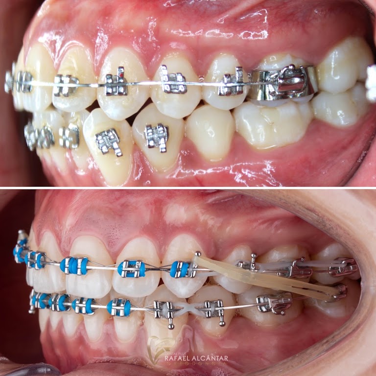 Dental Plus Pátzcuaro foto 1